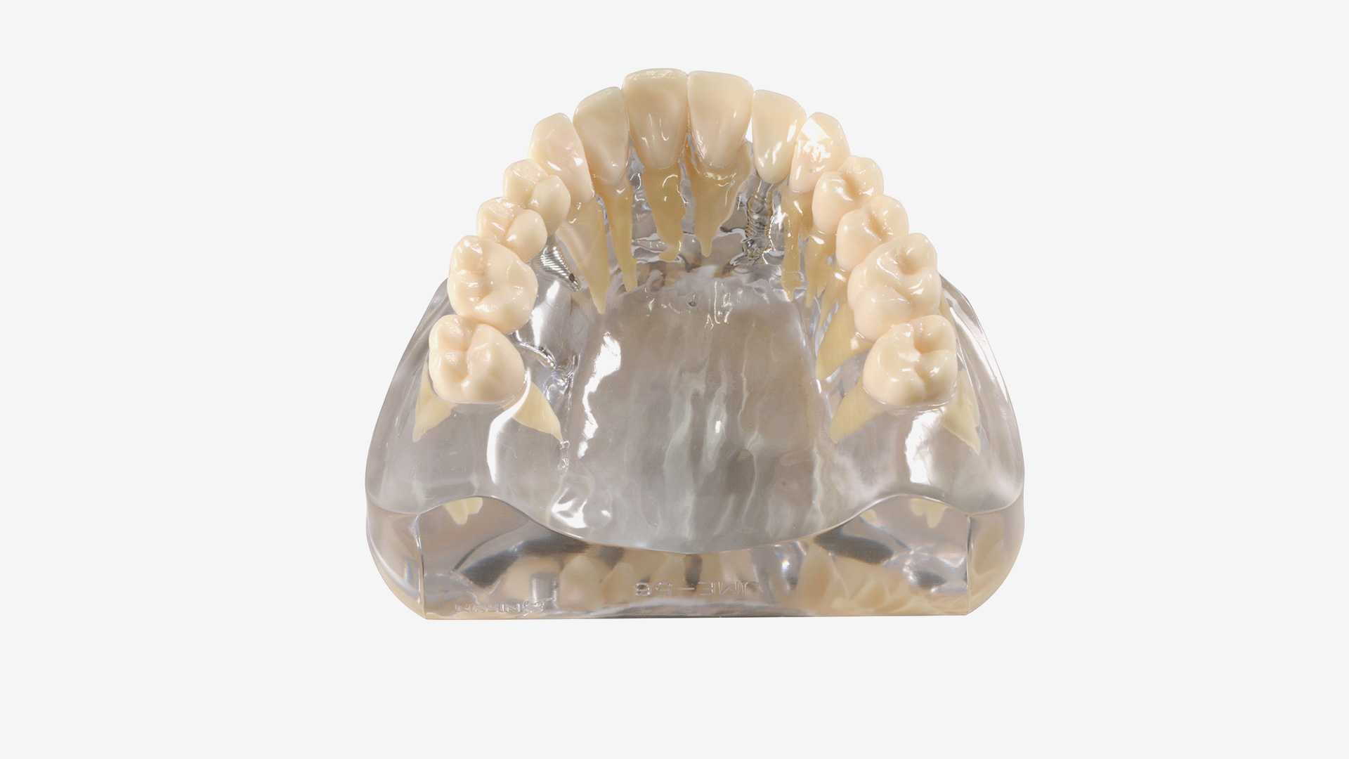 iP12-SB10 Implantatmodell OK mit Krone + Brücke